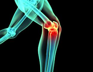 O grande vilão do joelho é a torção. Meniscos, ligamentos, tendões e cartilagens podem sofrer lesões quando o atleta mantém o pé parado, fixo no chão, e gira o corpo sobre o joelho
